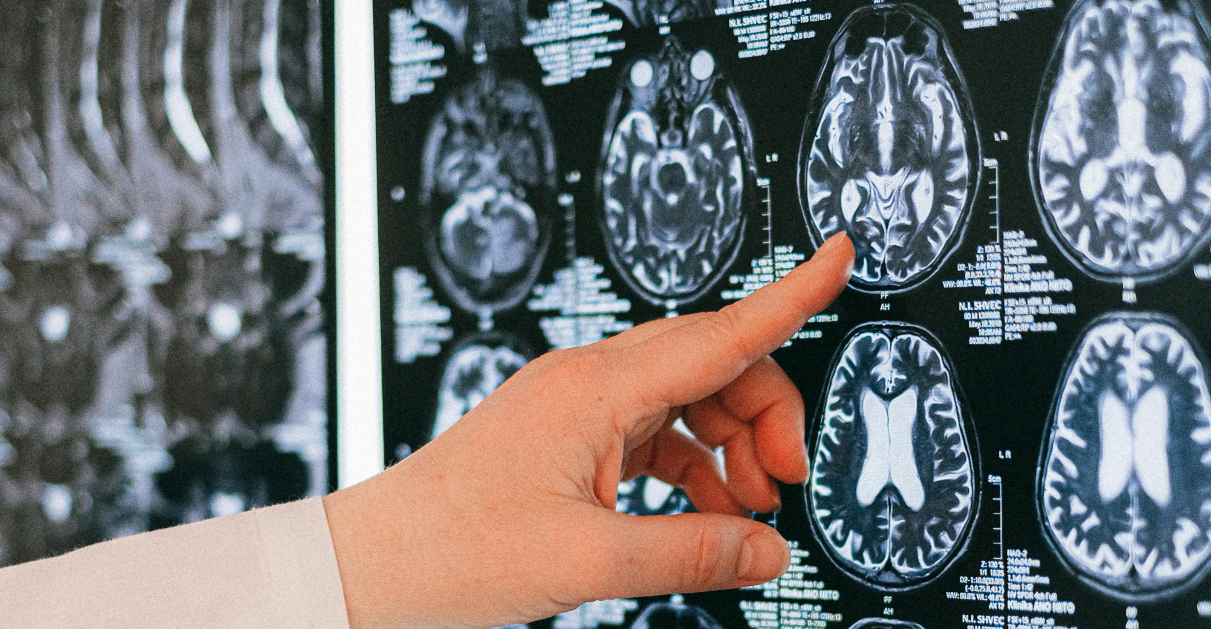 Neurones en activité